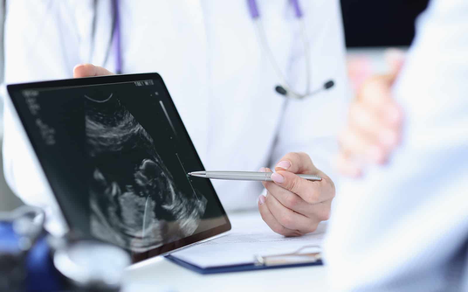 doctor demonstrates fetal ultrasound on tablet screen